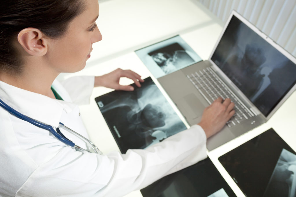 Doctor looking at x-rays for depuy asr hip replacement lawsuits